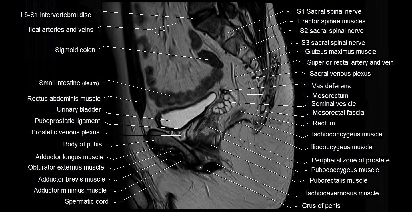 male pelvis sagittal cross sectional anatomy 3T mri image 28.webp